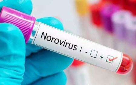 Norovirüs Salgını : Semptomlar, Tedaviler